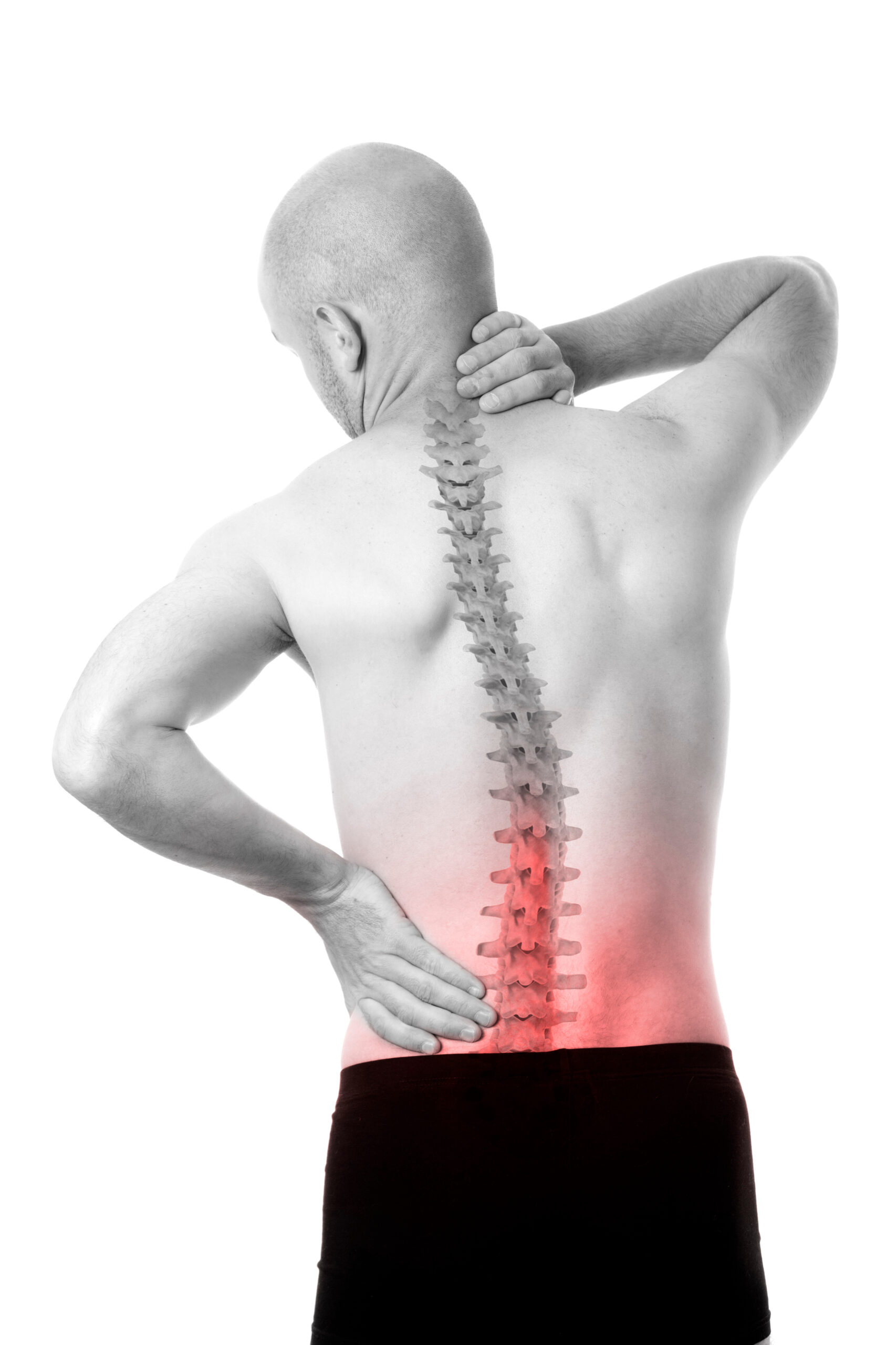 Scoliosis treatment at Wilke Chiropractic